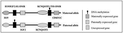 Roles of Type 1 Insulin-Like Growth Factor (IGF) Receptor and IGF-II in Growth Regulation: Evidence From a Patient Carrying Both an 11p Paternal Duplication and 15q Deletion